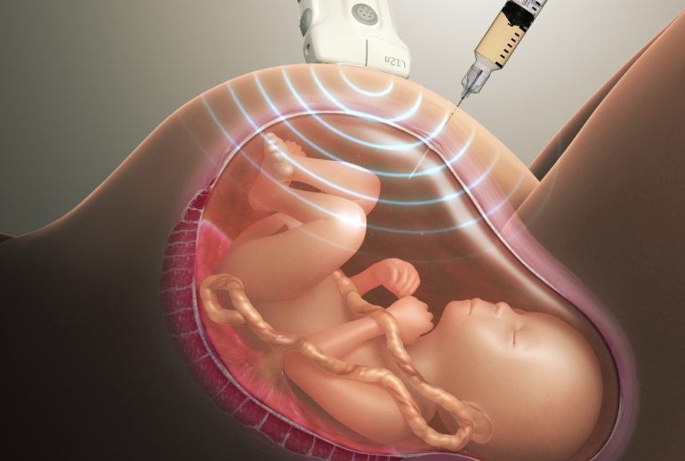 دکتر آمنیوسنتز در اهواز